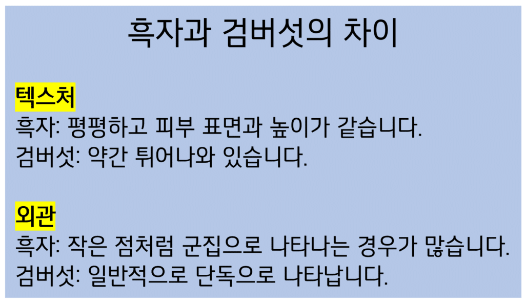 흑자 검버섯 차이